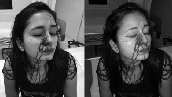 nita korban penganiayaan saat menjalani perawatan medis